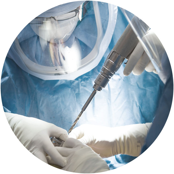 Surgical Power